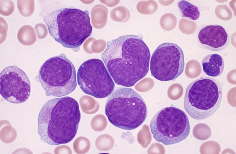 Leukemia in Canada: Symptoms, Diagnosis, Treatment Options, and Real-World Support